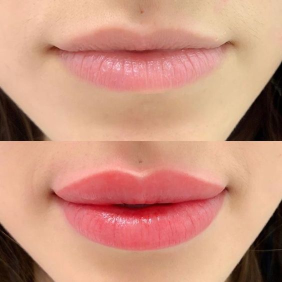 Lip Blushing